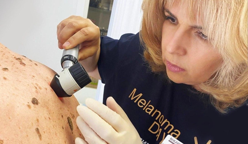 Всеукраїнський День діагностики меланоми